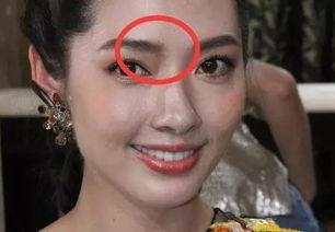 脸蛋上有疤痕的女明星,揭秘拥有独特印记的女明星风采